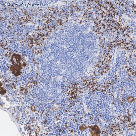 HUABIO HA751202 image 2