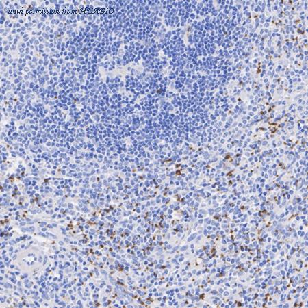 HUABIO HA751203 image 3