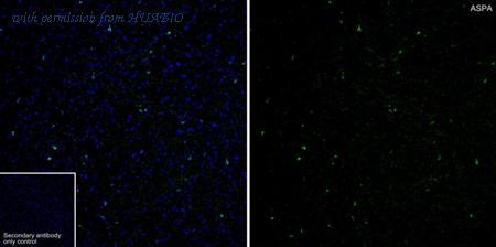 HUABIO HA751204 image 1