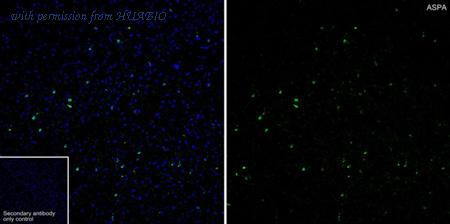 HUABIO HA751204 image 2