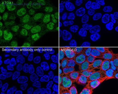 HUABIO HA751225 image 2