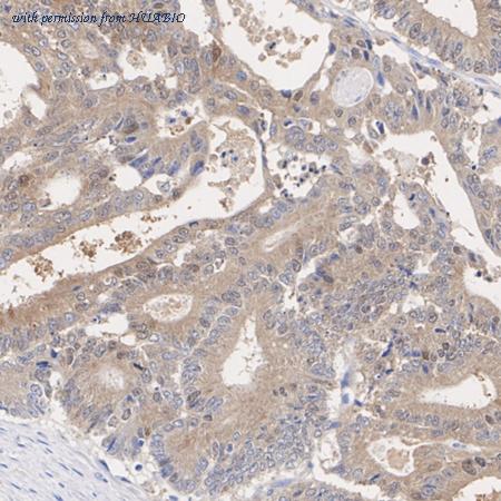 HUABIO HA751260 image 3