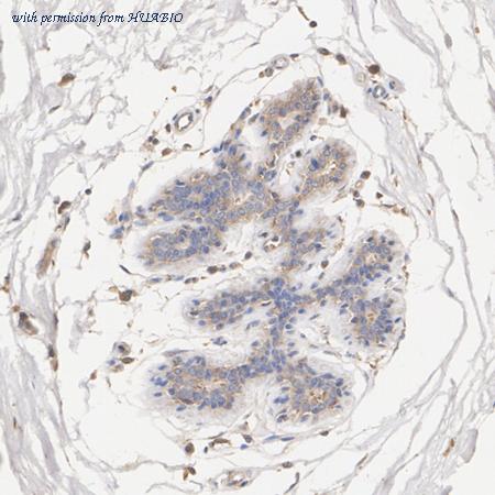 HUABIO HA751267 image 2