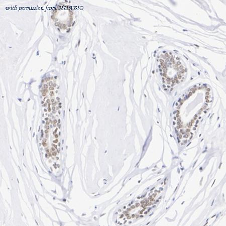 HUABIO HA751270 image 2