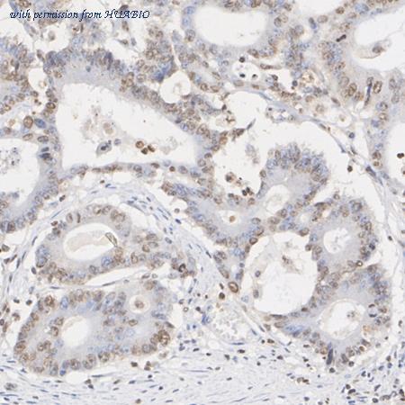 HUABIO HA751270 image 3