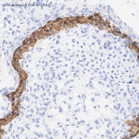 HUABIO HA751306 image 3