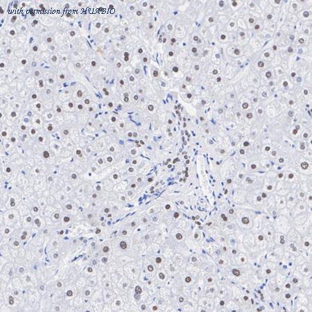 HUABIO HA751322 image 2