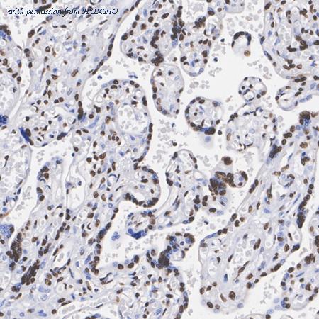 HUABIO HA751322 image 3