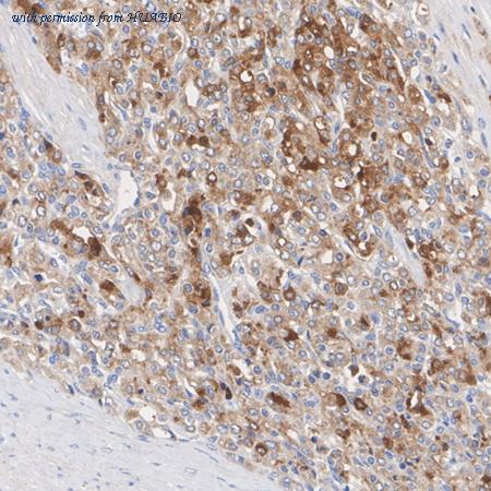 HUABIO HA751339 image 3