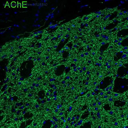 HUABIO HA751358 image 3