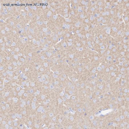 HUABIO HA751364 image 2