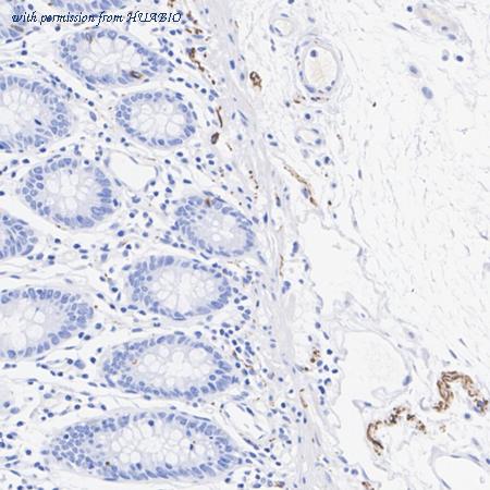 HUABIO HA751372 image 3