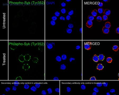 HUABIO HA751422 image 2