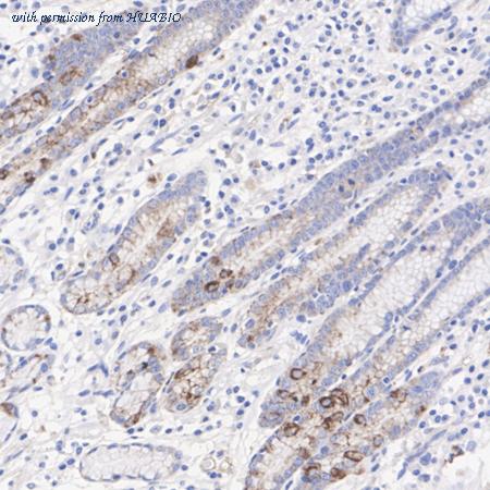 HUABIO HA751458 image 3