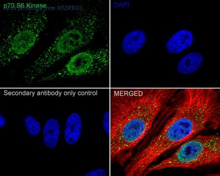 HUABIO HA751469 image 2