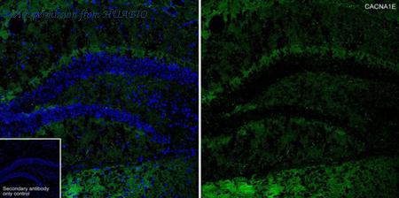 HUABIO HA751470 image 1