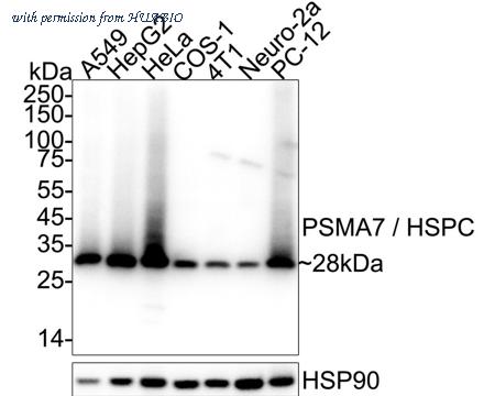 HUABIO HA751504 image 1