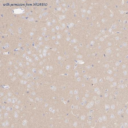 HUABIO HA751545 image 2