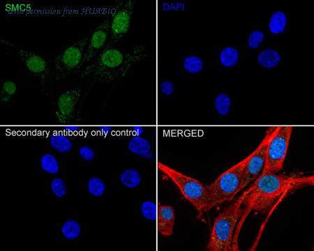 HUABIO HA751551 image 2