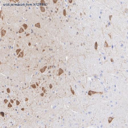 HUABIO HA751564 image 3