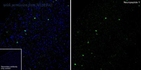 HUABIO HA751601 image 1