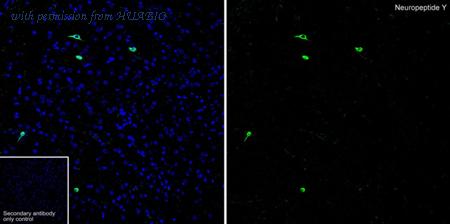 HUABIO HA751601 image 2