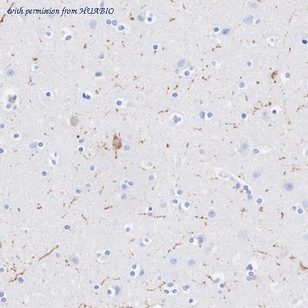 HUABIO HA751601 image 3