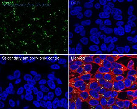 HUABIO HA751603 image 3