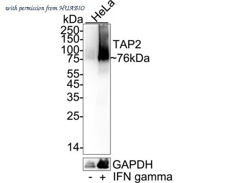 HUABIO HA751604 image 2