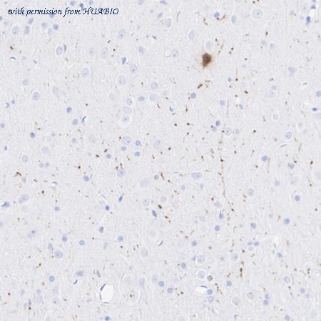 HUABIO HA751606 image 3