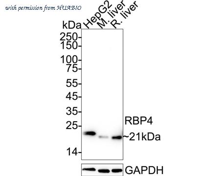 HUABIO HA751611 image 1