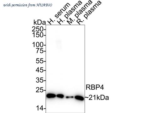 HUABIO HA751611 image 2