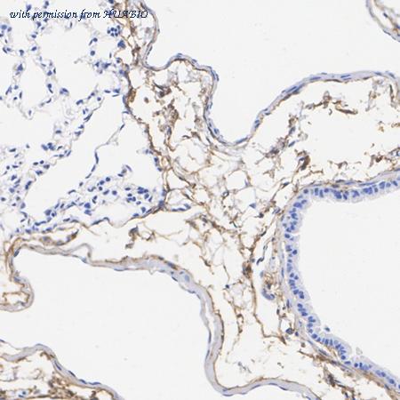 HUABIO HA751612 image 3