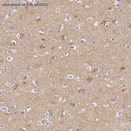 HUABIO HA751613 image 2