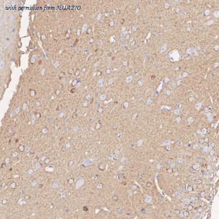 HUABIO HA751613 image 3