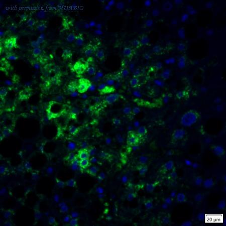 HUABIO IRS033 image 1