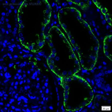 HUABIO IRS130MS image 1
