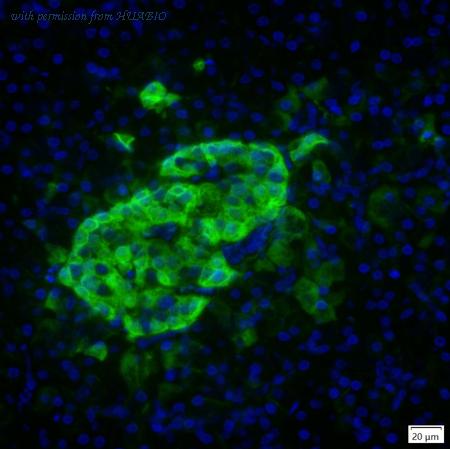 HUABIO IRS150RB image 1