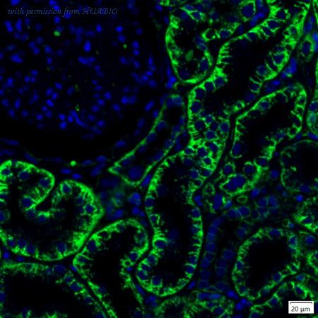 HUABIO IRS164RB image 1