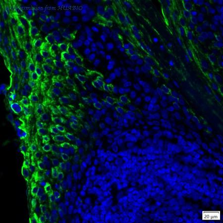 HUABIO IRS174MS image 1