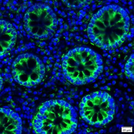 HUABIO IRS174MS image 2