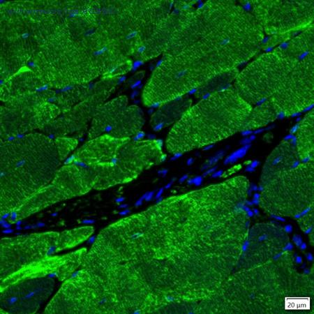 HUABIO IRS177RB image 1