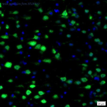 HUABIO IRS178RB image 1