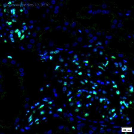 HUABIO IRS216RB image 1