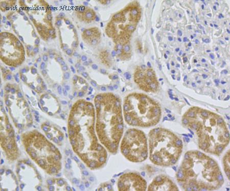 HUABIO M1011-1 image 2