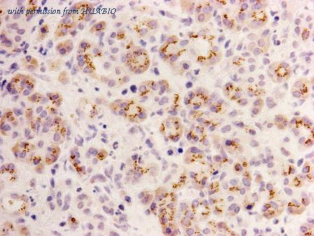 HUABIO M1301-2 image 3