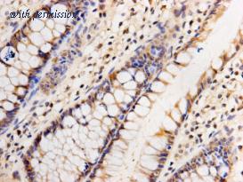 HUABIO M1306-2 image 2