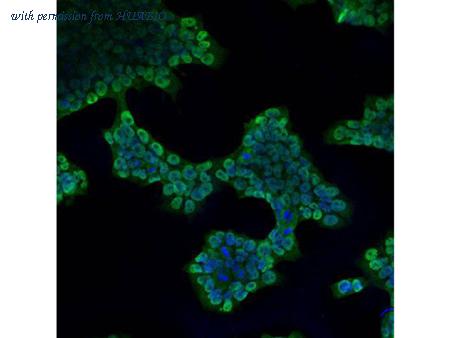 HUABIO M1312-1 image 2