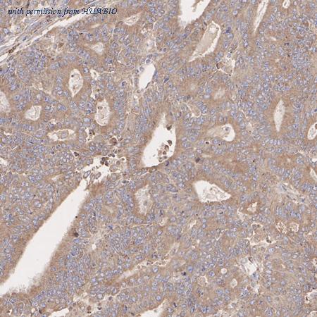 HUABIO M1505-1 image 1