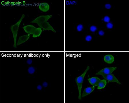 HUABIO M1506-1 image 2
